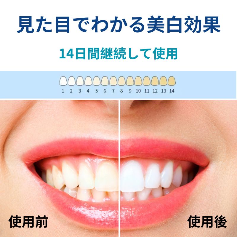 14日継続使用の色見本と口元の比較図