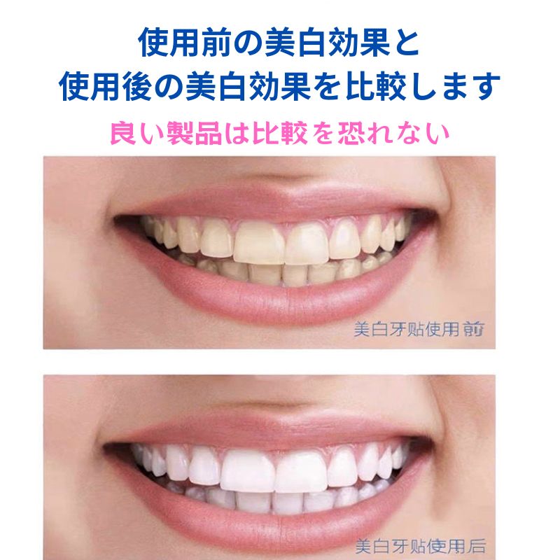 使用前後の口元の比較イメージ