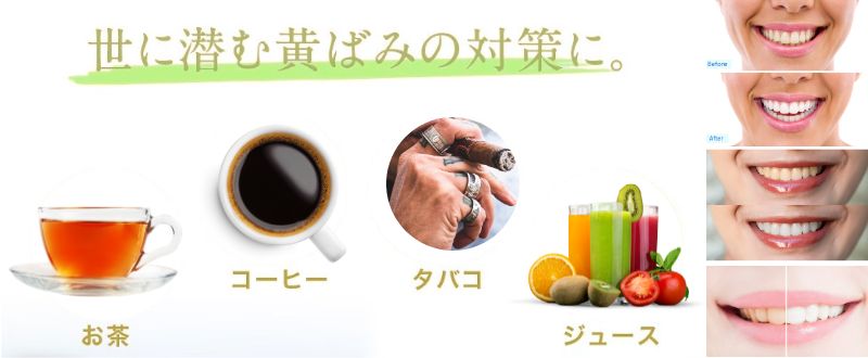 お茶・コーヒー・タバコ・ジュースなど着色原因の説明